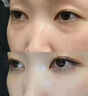 北京同仁堂眼霜類(lèi)蛇毒肽抗皺眼霜可搭細紋黑眼圈眼袋脂肪粒眼霜保濕抗皺眼膜 單盒 曬單實(shí)拍圖