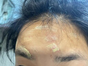 韓倫美羽多效舒緩祛痘膏壬二酸祛痘膏精華霜舒緩淡化痘印粉刺閉口控油正品 2支裝=每支到手14.9【拍1發(fā)2】 曬單實(shí)拍圖