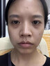 絲幕眼袋去除神器眼袋嚴(yán)重問(wèn)題中老年男女士毒蛇肽眼霜黑眼圈嚴(yán)重眼袋 一瓶【體驗(yàn)裝】 曬單實(shí)拍圖