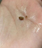 L-CALORIE艾斯貝利石素搭icybay腎臟膠囊調(diào)理腎結(jié)利石男女通用官方旗艦店 2瓶基礎(chǔ)裝 京官方店?yáng)|自旗艦營(yíng)藥房直售 曬單實(shí)拍圖