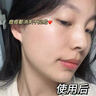 維特絲壬二酸祛痘藥膏去痘痘粉刺閉口收毛孔男女煙酰胺水楊酸青少年凝膠 曬單實拍圖