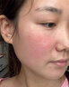 ning進(jìn)口曬后修復(fù)凝膠面部肌膚膏臉曬傷修復(fù)急救補(bǔ)水保濕冰沙霜男女士 曬單實(shí)拍圖
