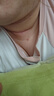 美皮護(hù)疤痕貼疤痕護(hù)理Mepiform瑞典原裝進(jìn)口剖腹產(chǎn)兒童自粘性軟聚硅酮敷料原裝進(jìn)口剖腹產(chǎn)甲狀腺 美皮護(hù)10cm-18cm一片 曬單實(shí)拍圖