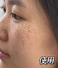 儒意（RUYI）377美白精華液淡斑面部抗皺緊致提亮去黃祛痘印煙酰胺抗氧補(bǔ)水 曬單實(shí)拍圖