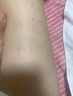 BOOMHUE美國進(jìn)口七葉樹(shù)膠囊調理腿部靜脈青筋凸起呵護蚯蚓腿平復大小腿ZY 3瓶調理裝 【買(mǎi)二送一】修復養護 曬單實(shí)拍圖
