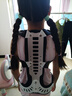 協(xié)愈脊柱側彎矯正器醫用駝背矯正器背部矯姿帶成人矯正護具 J-S 曬單實(shí)拍圖