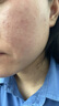 可復(fù)美醫(yī)用皮膚液體敷料補(bǔ)水次拋狀創(chuàng)面護(hù)理1.2mLx7支x4袋/盒 曬單實(shí)拍圖
