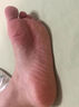 云南本草腳臭噴霧腳氣腳癢腳出汗真菌感染根ii治腳氣噴霧劑專用特效克星 藥噴劑一盒【腳臭噴霧】 曬單實拍圖