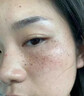 佰束美白祛斑霜去祛黃褐斑雀斑曬斑淡化色斑黑色素改善暗沉正品面霜 2瓶【第二瓶半價】 曬單實拍圖