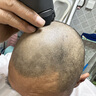 奧克斯（AUX）自助理發(fā)器六頭理發(fā)器男士剃圓頭剃光頭神器全身水洗網(wǎng)紅飛碟理發(fā)器成人自助剪發(fā)器電動理發(fā)器 自己理發(fā)器【單手理光頭】 曬單實拍圖