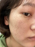 卡尼爾泰國原裝進口防曬霜祛斑美白精華消除曬斑曬傷美白去痘印套裝 曬單實拍圖