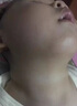 絲凱麗爐甘石寶寶倍護舒緩膏/寶寶溫和修復膏兒童皮膚過敏紅屁股 16g/支 一歲以上爐甘石寶寶倍護舒緩膏 1盒裝/16g*1 曬單實拍圖