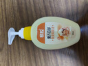 易控虱子藥兒童頭虱百部酊祛小女孩孕婦頭發(fā)虱卵洗發(fā)水成人陰虱液2瓶 曬單實(shí)拍圖