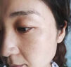 碧素堂去斑去黑色素祛斑霜白美淡化老年黃褐雀斑黑色素臉部專用醫(yī)用正品 一盒裝 祛斑效果最好的產(chǎn)品 曬單實(shí)拍圖