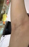 久研制藥胳膊肘去黑肘部黑色素手指關(guān)節去黑神器脖子手肘腋下膝蓋屁股坐印大腿內側黑色素沉淀變白霜男女 【第二件五折】98%顧客的選擇 曬單實(shí)拍圖