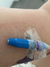 艾貝爾一次性無(wú)菌輸液正壓接頭picc醫用置管中心靜脈留置無(wú)針密閉 藍色【1個(gè)】 曬單實(shí)拍圖
