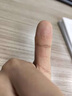 【日本品牌】醫(yī)用去手指疣尋常疣除膏專用神器刺猴膏清寧可搭藥BD 送醫(yī)用棉簽【兩盒裝】局部瘙癢疼痛 曬單實(shí)拍圖