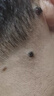 疣瘊克皮贅肉粒去除神器脖子上長的小疙瘩肉瘤祛疣體瘊猴子專用脫落藥膏 特效1盒【去扁平疣絲狀疣點痣】 曬單實拍圖