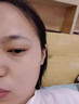 去疤痕修復(fù)凝膠醫(yī)院專用祛疤膏手術(shù)縫針增生凸起除疙瘩淡化黑色素 1盒【祛疤痕專用修復(fù)】多買多送部分地區(qū)次日達(dá) 芭痕克星醫(yī)用硅酮去除巴痕修復(fù)凝膠愈合傷口 曬單實(shí)拍圖