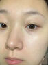 Newliann點痣膏點痣修復液臉部祛痣點疣藥水去黑痣痦子醫(yī)美專用官方正品 曬單實拍圖