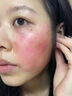 伊生優(yōu)美膠原蛋白重組醫用冷敷貼藍銅肽凍干粉六勝肽冰膜洋甘菊修復面膜 伊生優(yōu)美醫用敷貼 一盒【5片】 曬單實(shí)拍圖