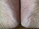 BEAI皸裂腳裂膏腳后跟防干裂皸裂龜裂開(kāi)裂凍裂膏護(hù)手足干裂潤(rùn)膚霜 曬單實(shí)拍圖