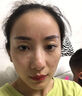 FLYMAN點(diǎn)痣膏水疤痕修復(fù)去痣點(diǎn)痣膏點(diǎn)疣水醫(yī)用專(zhuān)用(非藥)官方正品祛痣膏 套裝一:【點(diǎn)痣+修復(fù)】一盒 (100%發(fā)貨特效快)美容院專(zhuān)用不留疤不留坑 曬單實(shí)拍圖