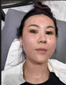 仟奈天倍三型膠原蛋白水光原液除皺針自打針劑美白保濕補(bǔ)水去眼袋黑眼圈 一盒修復(fù)面膜 官方正品防偽可查居家滾輪微針精華液可自打 曬單實(shí)拍圖