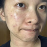LD進口原料男女士水楊酸控油祛痘保濕除螨蟲去角質(zhì)黑頭縮毛孔洗面奶 二盒裝【橫掃油螨痘斑 不反復(fù)】 曬單實拍圖