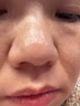 鮮約韓紀茶樹(shù)去黑頭導出精華液套盒收縮毛孔深層清潔鼻子粉刺閉口鼻貼 1盒體驗裝【去黑頭精華套盒】 曬單實(shí)拍圖