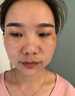 片仔癀美白淡斑套裝淡化黑色素老年黃褐雀斑曬斑提亮去黃祛斑霜護(hù)膚品女 五件套【潔面+水+乳+精華+霜】 曬單實(shí)拍圖