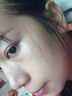 香港大藥房藏藥藏牛脂疤痕膏修復豆印斑點(diǎn)黑點(diǎn)修復膏痘印痘坑疤膏 【藏牛脂疤痕膏】3瓶療裝 曬單實(shí)拍圖