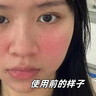 奈皙日本曬后修復面膜急救敏感泛紅女男士夏季神經酰胺改善醫(yī)美用煥白 曬單實拍圖