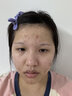 ELL清潔泥膜紫蘇壬二酸控油祛痘收毛孔粗大保濕舒緩緊致肌膚涂抹面膜 【拍1發(fā)13】二代泥膜+紫蘇潔面泥 曬單實拍圖