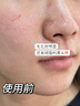 初蔓氨基酸洗面奶男女士控油祛痘除螨蟲去黑頭深層清潔收縮毛孔潔面乳 【控油凈毛孔】B5潔面乳*1支 明星推薦B5洗面奶熱銷榜TOP 曬單實拍圖