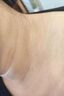 千紹方脖子黑色素沉淀去除治黑棘皮癥藥膏男女胖胳膊肘腋下去黑色素神器 3盒裝【900+顧客選擇】買二送一 曬單實(shí)拍圖