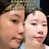 百靈鳥(niǎo)貴州百靈美白祛斑霜美白淡化老年黃褐雀斑黑色素曬斑色斑 5支【鞏固穩(wěn)定肌膚】全臉凈白 曬單實(shí)拍圖