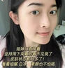 歐依唯官方旗艦歐依唯祛斑精華液補水美白精華改善肌理面部男女通用 1瓶30ml 曬單實(shí)拍圖