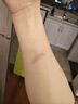 桃之夭夭強(qiáng)力臉部遮瑕膏無痕遮蓋紋身黑眼圈痘印吻痕胎記防水防汗深膚色 曬單實(shí)拍圖