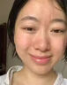 阿達帕林凝膠改善毛孔粗大去看黑頭醫(yī)用祛的痘消炎痤瘡硬疙瘩專用藥痘痘粉刺痘印治療粉刺膿包（視覺特效） 三盒裝【祛痘消炎 痤瘡膿包滿臉痘痘】熱賣款 曬單實拍圖