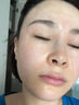 醫(yī)用冷敷貼面膜械字號醫(yī)美術(shù)后消炎美白補水曬后修復收縮毛孔祛痘淡化痘印生長因子重組三型人源膠原蛋白敷料 曬單實拍圖
