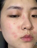 Newliann醫(yī)用重組膠原蛋白修復(fù)敷料乳液人表皮生長(zhǎng)因子凝膠皮膚屏障面霜 曬單實(shí)拍圖