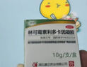 醫(yī)用蚊蟲叮咬止癢消腫特新效期】藥嬰兒兒童寶寶藥膏快速蚊子毒蟲跳蚤臭蟲瘙癢皮膚用藥林可霉素利多卡因凝膠 1盒被蚊子咬蚊子咬涂的藥膏止癢抑菌100%發(fā)貨特效 曬單實(shí)拍圖