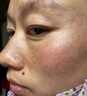 南京同仁堂南京同仁堂美白祛斑霜臉部手部老人斑雀斑曬斑祛除手背斑黑斑正品 1盒裝*/【體驗裝】正牌保證 曬單實拍圖