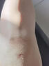 巡洋艦蚊蟲叮咬去疤痕去印祛疤膏去蚊子咬的疤痕黑印除疤嬰兒童專用修復(fù) 單盒裝 20g/支【建議周期使用】 曬單實(shí)拍圖