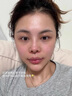 沃朗森醫(yī)用面膜型械字號醫(yī)美術后修復保濕補水消炎冷敷貼膠原蛋白 3盒 曬單實拍圖