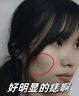 麥歌利點(diǎn)痣筆美容院專(zhuān)用儀器小白扁平疣掃斑專(zhuān)用筆家用淡斑掃斑筆洗紋身激光點(diǎn)斑消痣神器 藍色 限定禮盒 曬單實(shí)拍圖