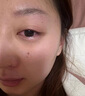 杰沐康干眼癥滴眼液眼睛干澀視力模糊眼疲勞治療眼罩瞼板腺堵塞疏通專(zhuān)用 單盒體驗(yàn)裝 曬單實(shí)拍圖