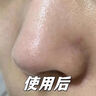 BAJK黑頭導(dǎo)出液鼻子去黑頭粉刺收縮毛孔深層清潔清理神器粗大修復(fù)閉口 【黑頭閉口粉刺】黑頭導(dǎo)出液*1瓶 黑頭粉刺丨收縮毛孔丨無效包退 曬單實(shí)拍圖