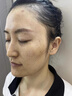 久卜制藥煙酰胺凝膠男士專(zhuān)用淡化黑色素色斑祛臉部白美可搭熊果苷乳膏*3 曬單實(shí)拍圖